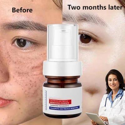 🔥2024 Hot Sale⏰ Last Day Buy 2 Get 1 Free-Vitamin C Whitening Freckles Face Cream