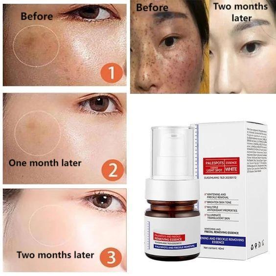 🔥2024 Hot Sale⏰ Last Day Buy 2 Get 1 Free-Vitamin C Whitening Freckles Face Cream