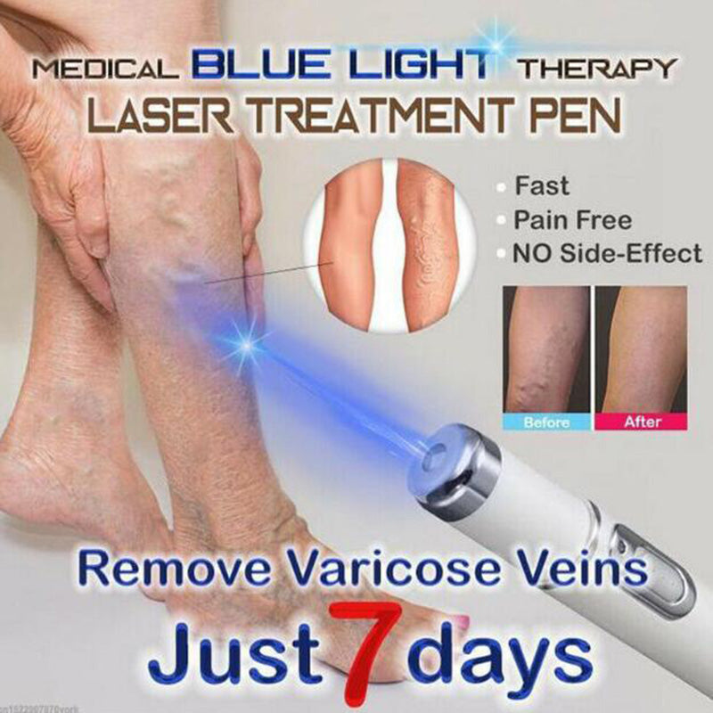 Blue Light Pen For Acne, Varicose Veins, Wrinkle Removal