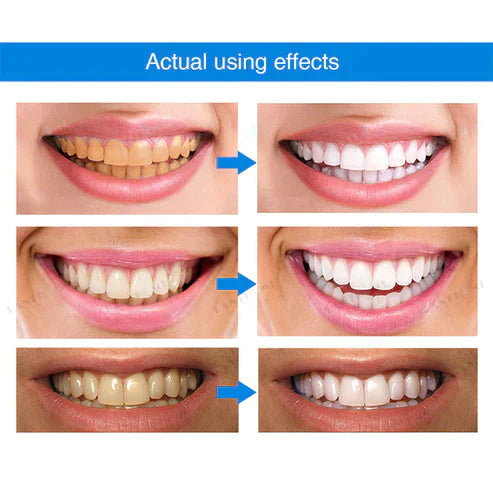 TEETH WHITENING ESSENCE（Buy 1 Free 1）